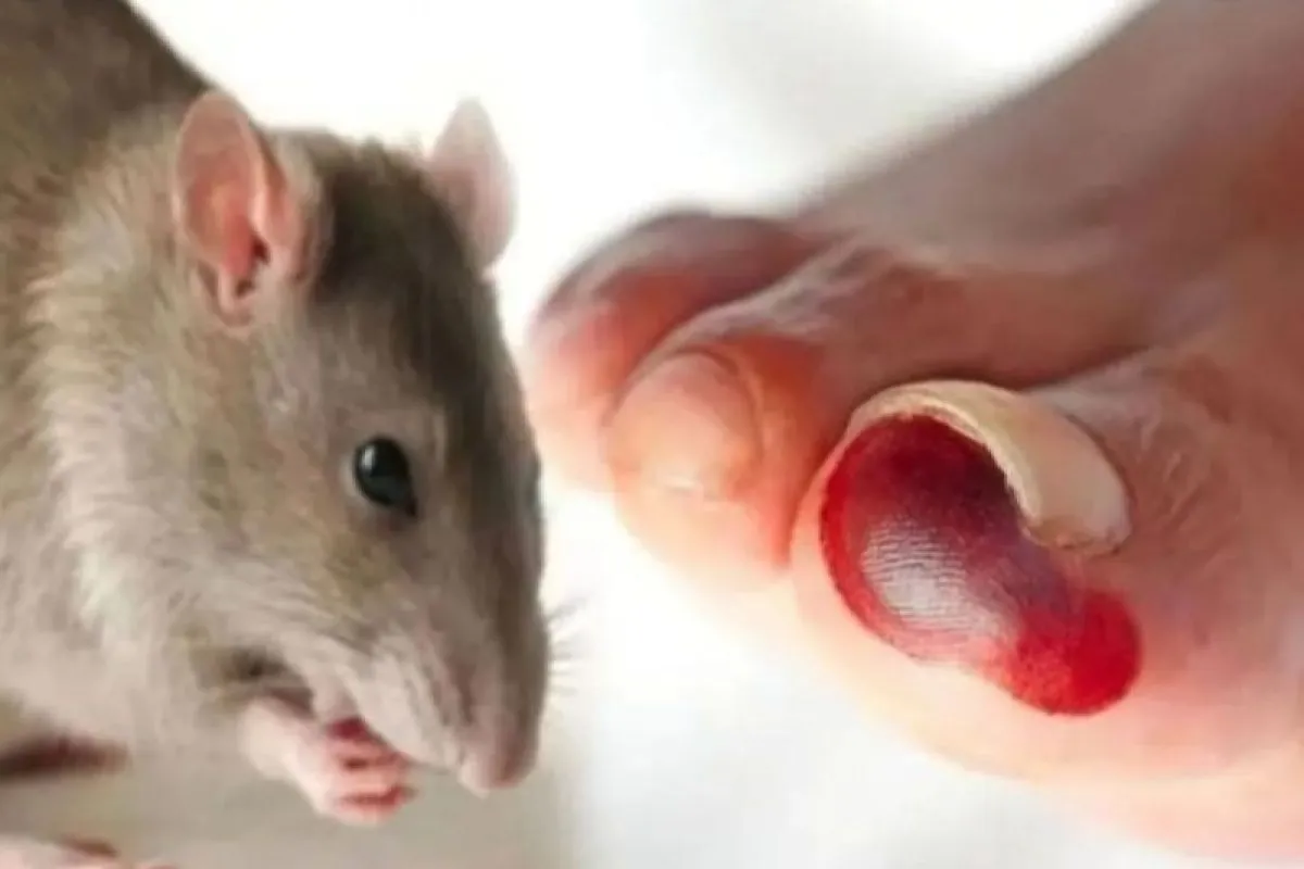 Waspada Hantavirus, Ini Cara Mencegah Infeksi Menular dari Tikus