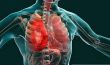 Dokter Ungkap 5 Kebiasaan Sederhana untuk Mengurangi Peradangan Kronis Tanpa Obat
