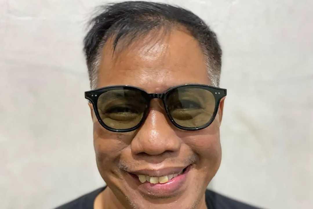 Komedian Temon Templar Meninggal Dunia di Usia 59 Tahun, Rekan Artis Berduka