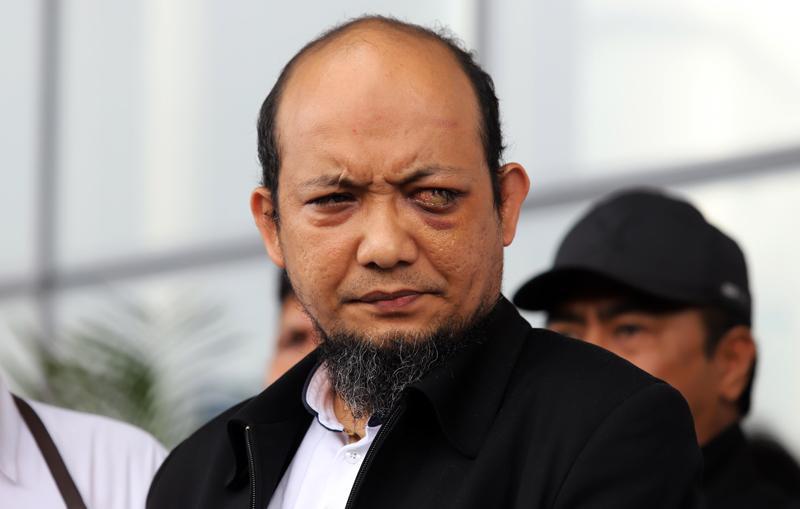  KPK: Mata Kiri Novel Baswedan tak Dapat Diperbaiki Kembali