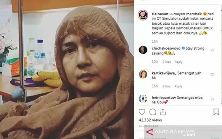 Kondisi Ria Irawan Sudah Kritis Sebelum Wafat