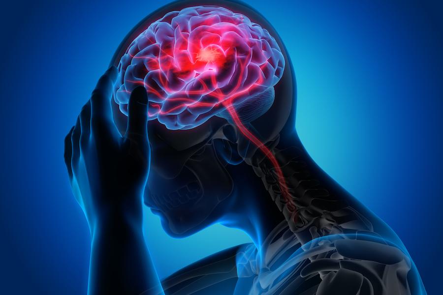  RS Siloam Luncurkan Layanan Tanggap Darurat Stroke