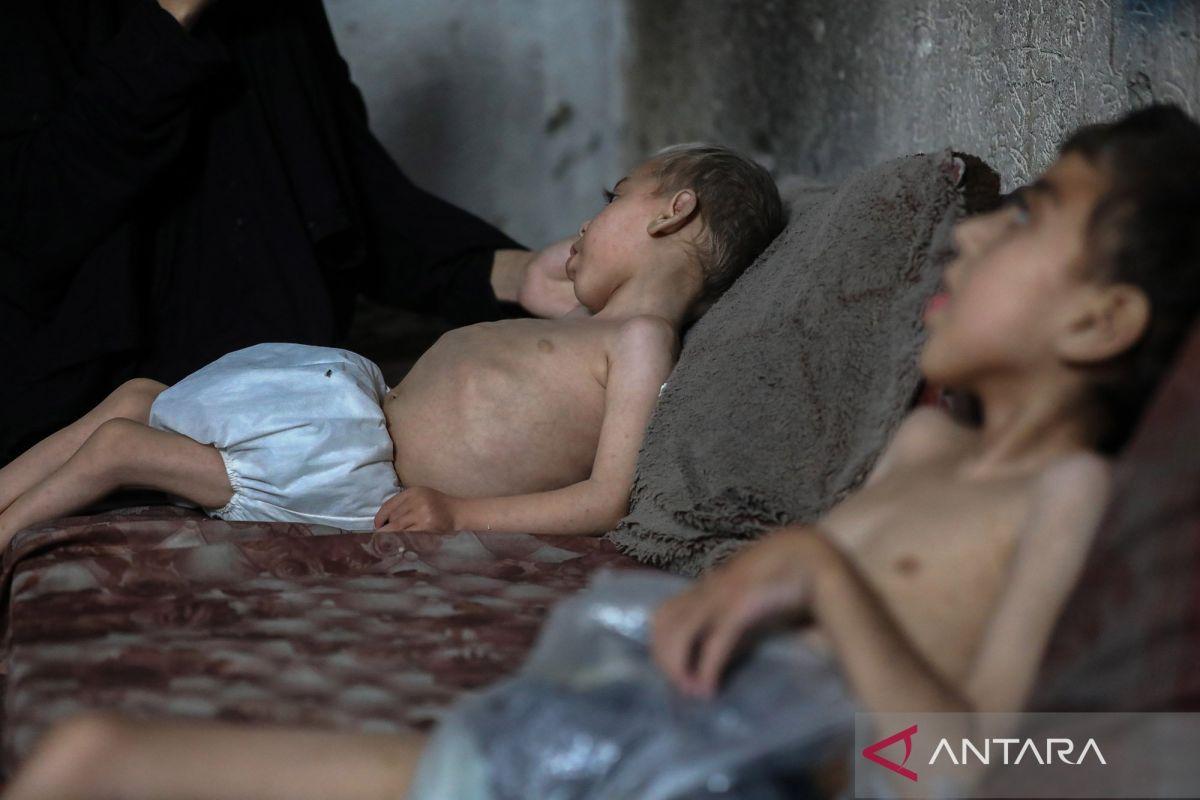  Inggris Siapkan Evakuasi 300 Anak Gaza yang Sakit Parah